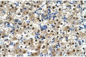 Immunohistochemical staining (Formalin-fixed paraffin-embedded sections) of human liver with GDE1 polyclonal antibody  at 4-8 ug/mL working concentration. (GDE1 antibody  (N-Term))
