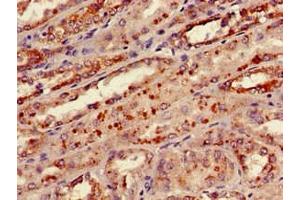 Immunohistochemistry of paraffin-embedded human kidney tissue using ABIN7157682 at dilution of 1:100 (KNG1 antibody  (AA 390-644) (Biotin))