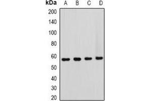 Western blot analysis of HOS expression in Hela (A), NIH3T3 (B), mouse brain (C), rat brain (D) whole cell lysates. (T-Box 5 antibody)