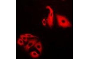 Immunofluorescent analysis of NFS1 staining in Hela cells. (NFS1 antibody)