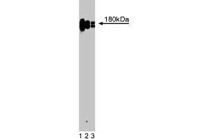 Western blot analysis of CD11a (Integrin alphaL) on a Jurkat cell lysate (Human T-cell leukemia, ATCC TIB-152).