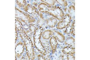 Immunohistochemistry of paraffin-embedded rat kidney using HAL antibody (ABIN6130467, ABIN6141593, ABIN6141594 and ABIN6216851) at dilution of 1:100 (40x lens). (HAL antibody  (AA 1-200))