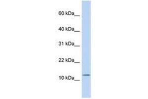 Image no. 1 for anti-Cholecystokinin (CCK) (C-Term) antibody (ABIN6740355) (Cholecystokinin antibody  (C-Term))