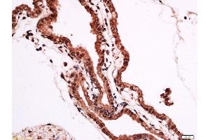 Formalin-fixed and paraffin embedded rat placenta labeled with Anti-FOXF1 Polyclonal Antibody, Unconjugated  at 1:200 followed by conjugation to the secondary antibody and DAB staining. (FOXF1 antibody  (AA 285-379))
