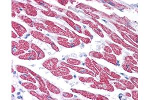 GPX4 antibody was used for immunohistochemistry at a concentration of 4-8 ug/ml.