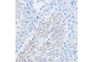 Immunohistochemistry of paraffin-embedded mouse testis using RALGDS antibody (ABIN7269838) at dilution of 1:100 (40x lens).