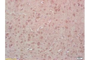 Immunohistochemistry (IHC) image for anti-Myocyte Enhancer Factor 2A (MEF2A) (pThr312) antibody (ABIN743768)