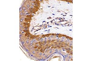 (ABIN6242624 and ABIN6577142) staining S100A2 in human skin tissue sections by Immunohistochemistry (IHC-P - paraformaldehyde-fixed, paraffin-embedded sections).