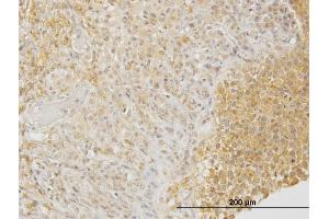 Immunoperoxidase of monoclonal antibody to DPYSL3 on formalin-fixed paraffin-embedded human ovary. (DPYSL3 antibody  (AA 457-555))