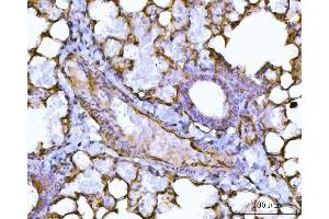 IHC analysis of PTRF/CAVIN1 using anti-PTRF/CAVIN1 antibody (ABIN7601817).