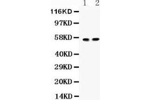 Anti- ICA1 Picoband antibody, Western blotting All lanes: Anti ICA1  at 0. (ICA1 antibody  (Middle Region))