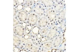 Immunohistochemistry of paraffin-embedded rat kidney using Pan-Akt Rabbit pAb (ABIN7265520) at dilution of 1:100 (40x lens). (AKT 1/2/3 antibody)