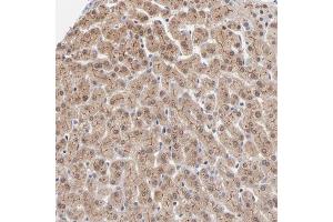 Immunohistochemical staining of human liver with WSB1 polyclonal antibody  shows cytoplasmic and membranous positivity in hepatocytes at 1:50-1:200 dilution.