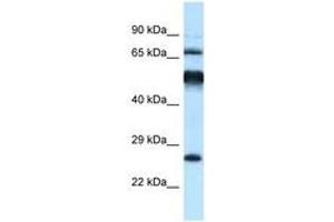 Image no. 1 for anti-Kelch-Like 1 (KLHL1) (AA 396-445) antibody (ABIN6747517)