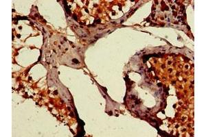 Immunohistochemistry of paraffin-embedded human testis tissue using ABIN7175913 at dilution of 1:100 (PEPD antibody  (AA 258-395))
