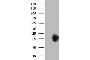 Western Blotting (WB) image for anti-Zinc Finger, AN1-Type Domain 2B (ZFAND2B) antibody (ABIN1501808) (ZFAND2B antibody)