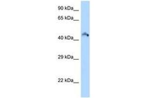 Image no. 1 for anti-Ribosomal Modification Protein RimK-Like Family Member B (RIMKLB) (AA 191-240) antibody (ABIN6748287) (RIMKLB antibody  (AA 191-240))