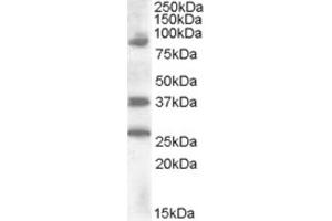 Western Blotting (WB) image for anti-Homeobox D10 (HOXD10) (Internal Region) antibody (ABIN2466797) (HOXD10 antibody  (Internal Region))
