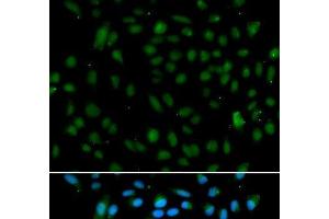 Immunofluorescence analysis of A549 cells using WHSC1L1 Polyclonal Antibody (WHSC1L1 antibody)