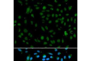 Immunofluorescence analysis of A549 cells using WHSC1L1 Polyclonal Antibody (WHSC1L1 antibody)