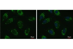 ICC/IF Image UQCRFS1 antibody [N1C3] detects UQCRFS1 protein at mitochondria by immunofluorescent analysis. (UQCRFS1 antibody)