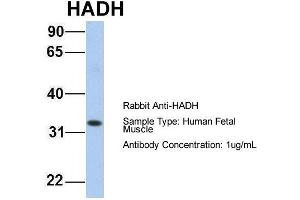 Host: Rabbit Target Name: HADH Sample Type: Human Fetal Muscle Antibody Dilution: 1. (HADH antibody  (C-Term))
