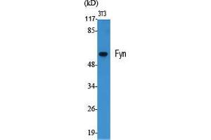 Western Blot (WB) analysis of specific cells using Fyn Polyclonal Antibody. (FYN antibody  (Ser400))
