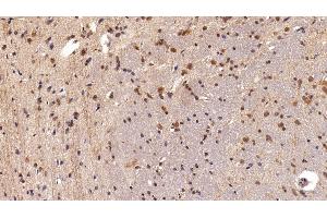 Immunohistochemistry (IHC) image for anti-High Mobility Group Box 1 (HMGB1) (AA 1-215) antibody (ABIN7431746)