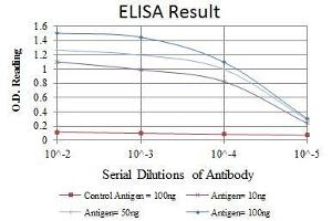 Red: Control Antigen (100 ng), Purple: Antigen (10 ng), Green: Antigen (50 ng), Blue: Antigen (100 ng), (OTX2 antibody)