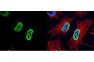 Immunofluorescence (IF) image for anti-RAD21 Homolog (RAD21) (Center) antibody (ABIN2856242)