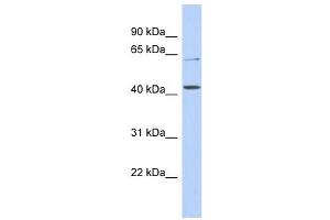 SLC22A12 antibody used at 1 ug/ml to detect target protein.