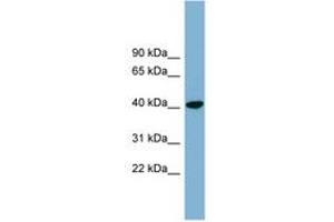 Image no. 1 for anti-PIN2/TERF1 Interacting, Telomerase Inhibitor 1 (PINX1) (AA 35-84) antibody (ABIN6744111) (PINX1 antibody  (AA 35-84))
