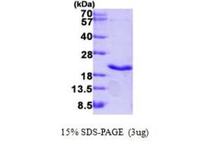 Lymphotoxin-alpha (LTA) (AA 35-205) (Active) protein (His tag)
