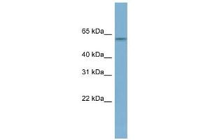 MYBPH antibody used at 1 ug/ml to detect target protein. (MYBPH antibody  (N-Term))