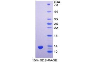 SDS-PAGE (SDS) image for Prostate Stem Cell Antigen (PSCA) (AA 22-95) protein (His tag) (ABIN1171203)