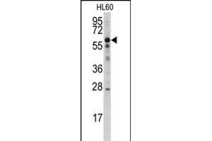 Western blot analysis of anti-MTM1 Antibody (N-term) (ABIN1882103 and ABIN2841036) in HL60 cell line lysates (35 μg/lane). (MTM1 antibody  (N-Term))