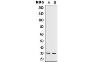 Western blot analysis of IL-5 expression in HeLa (A), HepG2 (B) whole cell lysates. (IL-5 antibody  (Center))