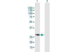 Western Blot analysis of FBXO17 expression in transfected 293T cell line by FBXO17 MaxPab polyclonal antibody. (FBXO17 antibody  (AA 1-278))