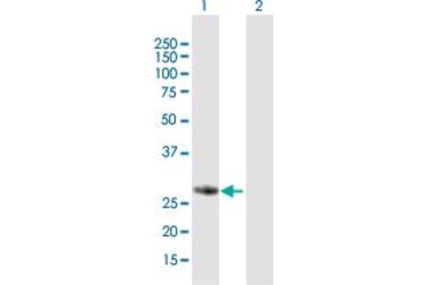 FBXO17 anticorps  (AA 1-278)