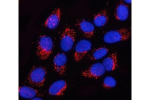 IF analysis of OGDHL using anti-OGDHL antibody (ABIN7598933). (OGDHL antibody  (AA 1-1010))