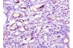 Immunohistochemistry of paraffin-embedded human kidney tissue using ABIN7149376 at dilution of 1:10 (NT5C1A antibody  (AA 1-368))
