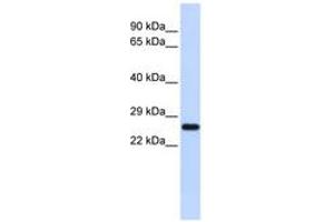 Image no. 1 for anti-Superoxide Dismutase 2, Mitochondrial (SOD2) (N-Term) antibody (ABIN6744284) (SOD2 antibody  (N-Term))