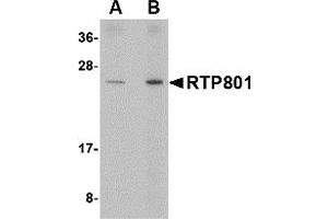 Western Blotting (WB) image for anti-DNA-Damage-Inducible Transcript 4 (DDIT4) (Middle Region) antibody (ABIN1031074)