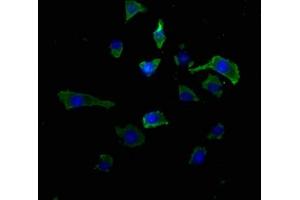 Immunofluorescence staining of SH-SY5Y cells with ABIN7167314 at 1:50, counter-stained with DAPI. (RAB39A antibody  (AA 1-217))