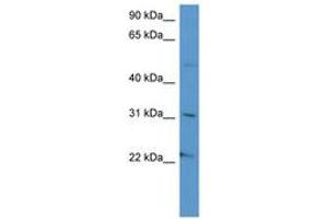 Image no. 1 for anti-Secretogranin III (SCG3) (AA 337-386) antibody (ABIN6746584) (SCG3 antibody  (AA 337-386))