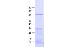 Validation with Western Blot (PRAME Protein (His tag))