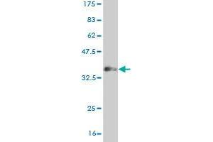 Western Blot detection against Immunogen (36. (MUSK antibody  (AA 301-400))