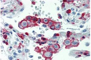 Lung, Human: Formalin-Fixed, Paraffin-Embedded (FFPE) (Integrin beta 2 antibody  (AA 534-546))