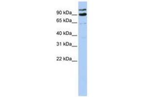 Image no. 1 for anti-LON Peptidase N-terminal Domain and Ring Finger 3 (LONRF3) (AA 612-661) antibody (ABIN6740816)