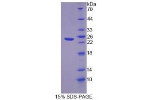 SDS-PAGE analysis of Human FLRT1 Protein. (FLRT1 Protein)